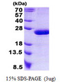 RAP2B Protein
