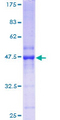 RAP2C Protein - 12.5% SDS-PAGE of human RAP2C stained with Coomassie Blue