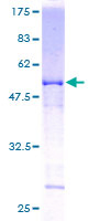 RAP30 / GTF2F2 Protein - 12.5% SDS-PAGE of human GTF2F2 stained with Coomassie Blue