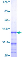 RAPGEF2 Protein - 12.5% SDS-PAGE Stained with Coomassie Blue.