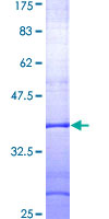 RAPGEF5 / GFR Protein - 12.5% SDS-PAGE Stained with Coomassie Blue.