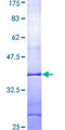 RAPGEF5 / GFR Protein - 12.5% SDS-PAGE Stained with Coomassie Blue.