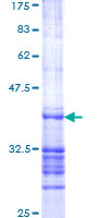 RAPGEF6 Protein - 12.5% SDS-PAGE Stained with Coomassie Blue.