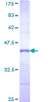 RAPGEFL1 Protein - 12.5% SDS-PAGE Stained with Coomassie Blue.