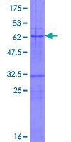 RAPSN Protein - 12.5% SDS-PAGE of human RAPSN stained with Coomassie Blue