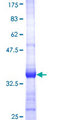 RAPSN Protein - 12.5% SDS-PAGE Stained with Coomassie Blue.