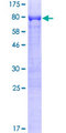 RARA / RAR Alpha Protein - 12.5% SDS-PAGE of human RARA stained with Coomassie Blue