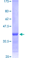 RARA / RAR Alpha Protein - 12.5% SDS-PAGE Stained with Coomassie Blue.
