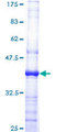 RARA / RAR Alpha Protein - 12.5% SDS-PAGE Stained with Coomassie Blue.