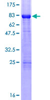 RARB / RAR Beta Protein - 12.5% SDS-PAGE of human RARB stained with Coomassie Blue