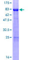 RARB / RAR Beta Protein - 12.5% SDS-PAGE of human RARB stained with Coomassie Blue
