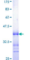 RARB / RAR Beta Protein - 12.5% SDS-PAGE Stained with Coomassie Blue.