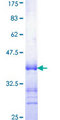RARB / RAR Beta Protein - 12.5% SDS-PAGE Stained with Coomassie Blue.
