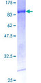 RARG / RAR-Gamma Protein - 12.5% SDS-PAGE of human RARG stained with Coomassie Blue