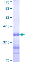RARG / RAR-Gamma Protein - 12.5% SDS-PAGE Stained with Coomassie Blue.