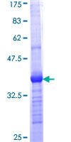 RARRES1 Protein - 12.5% SDS-PAGE Stained with Coomassie Blue.