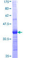 RARRES1 Protein - 12.5% SDS-PAGE Stained with Coomassie Blue.
