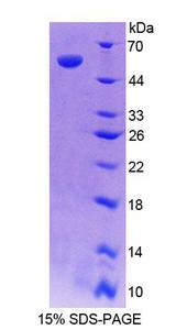 RARRES1 Protein - Recombinant Retinoic Acid Receptor Responder 1 By SDS-PAGE