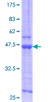 RARRES2 / Chemerin Protein - 12.5% SDS-PAGE of human RARRES2 stained with Coomassie Blue
