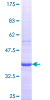 RARRES2 / Chemerin Protein - 12.5% SDS-PAGE Stained with Coomassie Blue.