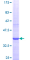 RARRES2 / Chemerin Protein - 12.5% SDS-PAGE Stained with Coomassie Blue.