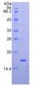 RARRES2 / Chemerin Protein - Recombinant Chemerin By SDS-PAGE