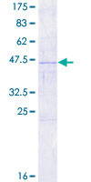 RARRES3 Protein - 12.5% SDS-PAGE of human RARRES3 stained with Coomassie Blue