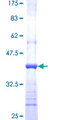 RARRES3 Protein - 12.5% SDS-PAGE Stained with Coomassie Blue.