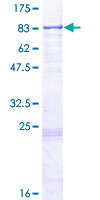 RARS2 / ARGRS Protein - 12.5% SDS-PAGE of human RARS2 stained with Coomassie Blue