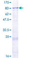 RARS2 / ARGRS Protein - 12.5% SDS-PAGE of human RARS2 stained with Coomassie Blue