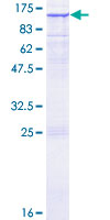 RASA1 Protein - 12.5% SDS-PAGE of human RASA1 stained with Coomassie Blue