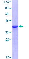 RASA1 Protein - 12.5% SDS-PAGE Stained with Coomassie Blue.