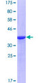 RASA1 Protein - 12.5% SDS-PAGE Stained with Coomassie Blue.