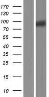 RASA4 / CAPRI Protein - Western validation with an anti-DDK antibody * L: Control HEK293 lysate R: Over-expression lysate