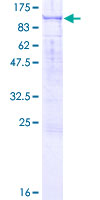 RASAL1 / RASAL Protein - 12.5% SDS-PAGE of human RASAL1 stained with Coomassie Blue