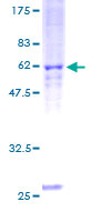 RASD2 Protein - 12.5% SDS-PAGE of human RASD2 stained with Coomassie Blue