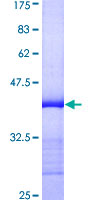 RASEF Protein - 12.5% SDS-PAGE Stained with Coomassie Blue.