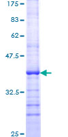 RASGRF1 / CDC25 Protein - 12.5% SDS-PAGE Stained with Coomassie Blue.