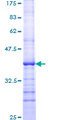 RASGRF1 / CDC25 Protein - 12.5% SDS-PAGE Stained with Coomassie Blue.