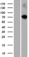 RASGRP4 Protein - Western validation with an anti-DDK antibody * L: Control HEK293 lysate R: Over-expression lysate