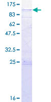 RASGRP4 Protein - 12.5% SDS-PAGE of human RASGRP4 stained with Coomassie Blue