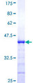 RASGRP4 Protein - 12.5% SDS-PAGE Stained with Coomassie Blue.