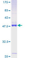 RASL10B Protein - 12.5% SDS-PAGE of human RASL10B stained with Coomassie Blue