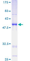 RASL11B Protein - 12.5% SDS-PAGE of human RASL11B stained with Coomassie Blue