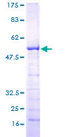 RASL12 Protein - 12.5% SDS-PAGE of human RASL12 stained with Coomassie Blue