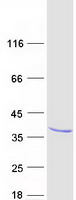 RASL12 Protein - Purified recombinant protein RASL12 was analyzed by SDS-PAGE gel and Coomassie Blue Staining