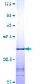 RASSF1 / RASSF1A Protein - 12.5% SDS-PAGE Stained with Coomassie Blue.