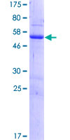 RASSF3 Protein - 12.5% SDS-PAGE of human RASSF3 stained with Coomassie Blue
