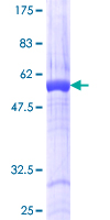 RASSF5 / RAPL Protein - 12.5% SDS-PAGE of human RASSF5 stained with Coomassie Blue