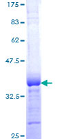 RASSF5 / RAPL Protein - 12.5% SDS-PAGE Stained with Coomassie Blue.